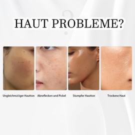 Alpha Arbutin 2% Serum gegen Dunklen Flecken, Akne, Poren, Hautverfärbungen, 2% Alpha Arbutin Serum mit Niacinamid, Gesichtsserum für Strahlenden und Anti-aging