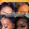 BEEOS Wear and Go 5x5 SKINLIK Real HD Lace Closure