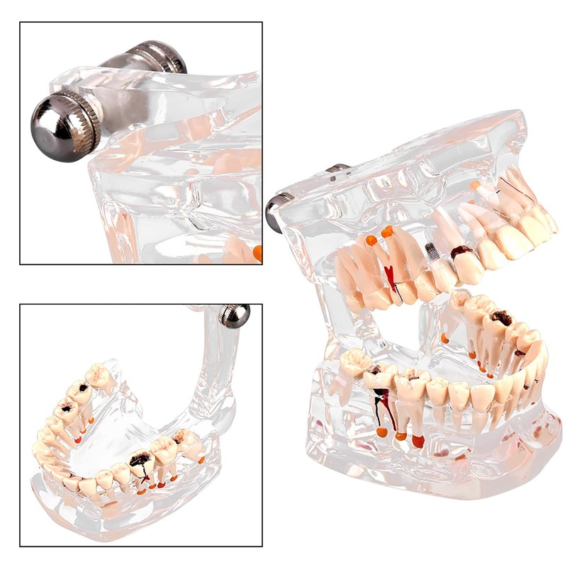 Standard Dental Model for Dentistry Students, Standard Study Teaching Dental