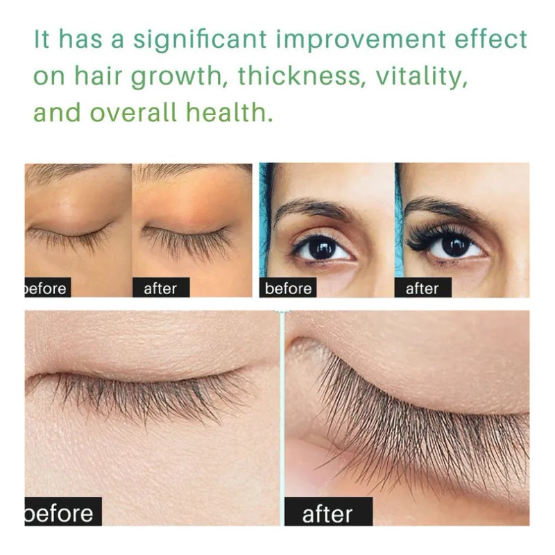 P Cabello De Crecimiento Cejas Potenciador Suero 30 Ml