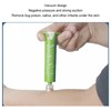 Bite Sucker Promote Healing Vacuum Negative Pressure Bite Extractor Tool