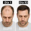 Tónico Maximus 20% Anticaída Para Crecer Barba Y Cabello
