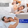Pack of 4 Grinding Splints for Night, Snoring Splint, Tooth