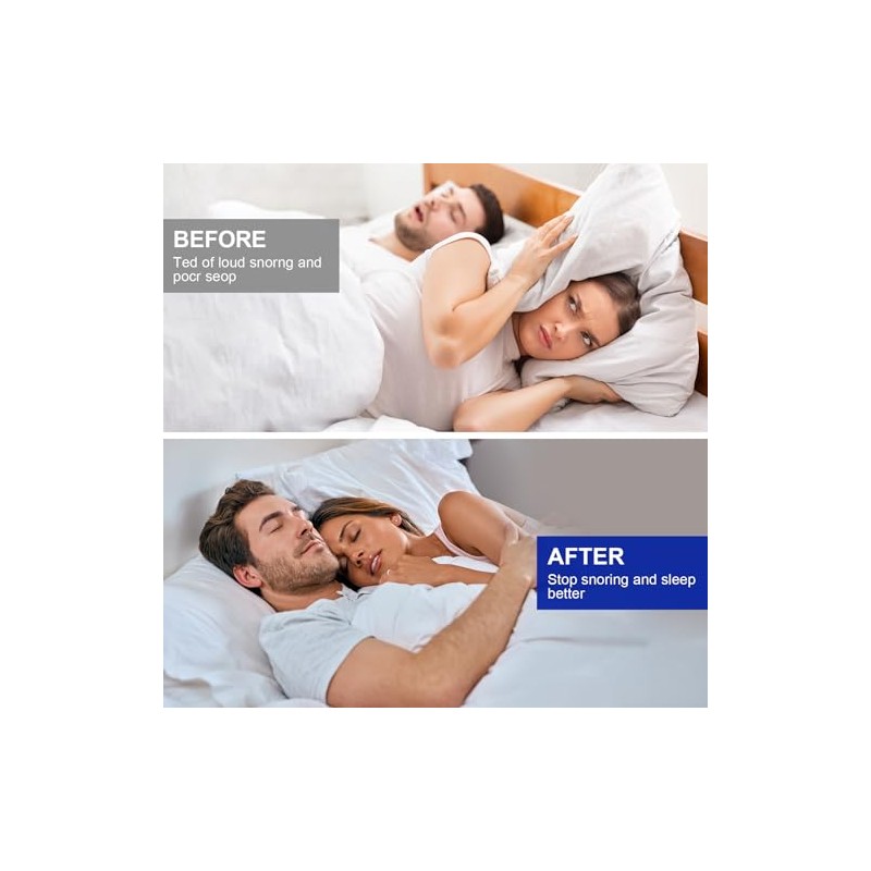 Pack of 4 Grinding Splints for Night, Snoring Splint, Tooth