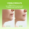 Dr.Melaxin Cactox V-Lifting Mewing Band With Cactus Cooling Reduce Puffiness