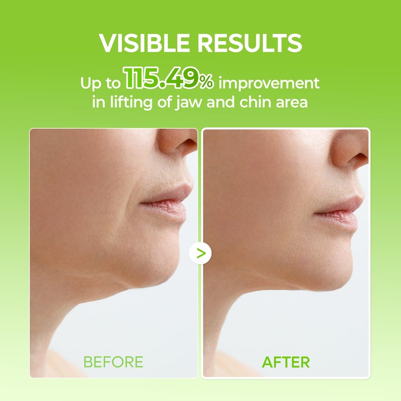 Dr.Melaxin Cactox V-Lifting Mewing Band With Cactus Cooling Reduce Puffiness