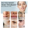 240pzs Hilos Colágeno Solubles Hidrolizado Absorbibles