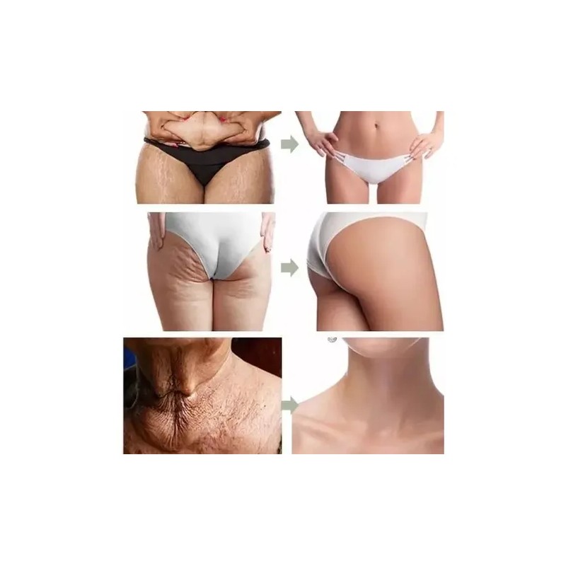 Crema\gel Abdominal P Reducir Abdomen Panza Celulitis Tallas