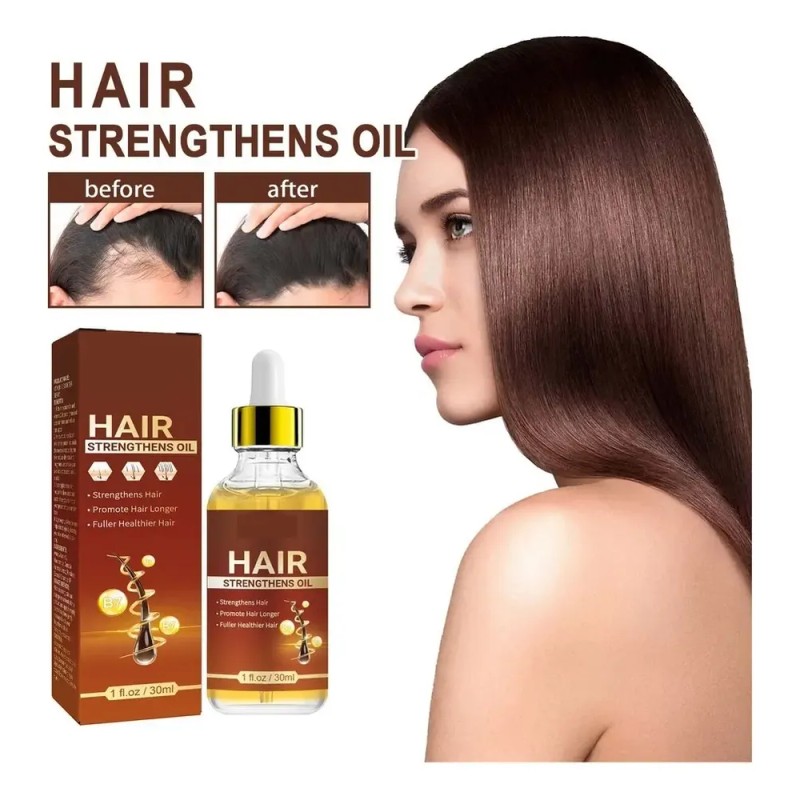 4×aceite Capilar 30 Ml Con Biotina Y Sérum Ricino Para