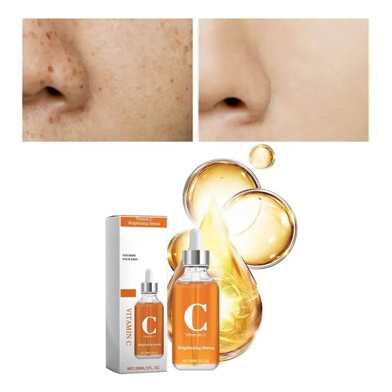 Vc Mist Vc Bruma Hidratante Útil Para Rostro De Todo
