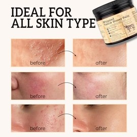 Beef Tallow Honey Balm for Skin: Grass-Fed Tallow Moisturizer with Manuka Honey - Olive Oil & Jojoba Oil & Shea Butter - Face and Body Balm for Dry & Sensitive Skin(4 oz)
