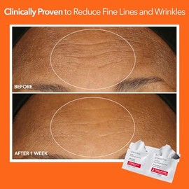 Dr Dennis Gross Alpha Beta Extra Strength Daily Peel: for Oily Skin, Uneven Tone or Texture, Wrinkles or Enlarged Pores (5 Treatments)