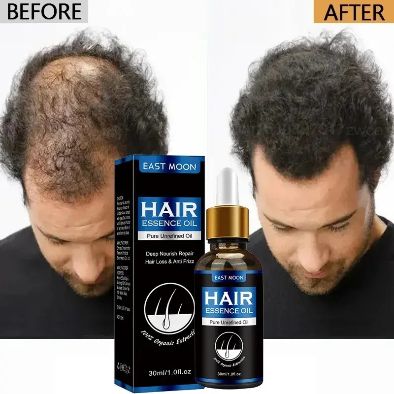Aceite Crecimiento Cabello
