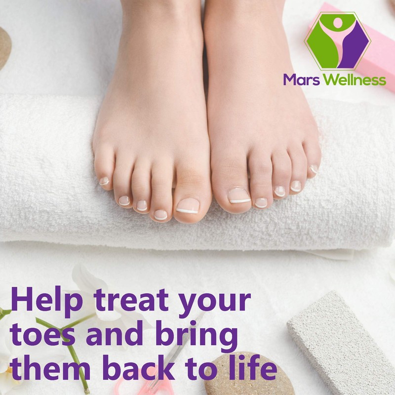 Mars Wellness Gel Toe Separators 1 Pair - Correct Bunions,