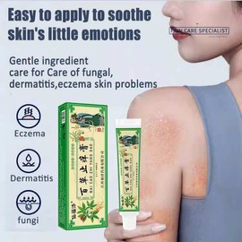 Ubat gatal kulit Cream gatal 止癢膏 20g skin Antibacterial skin wet poison and itching Herbal essence and mild repairs