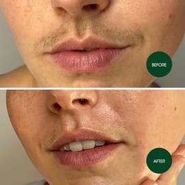 Nad's Tiras de cera facial, hipoalergénicas para todo tipo de piel, depilación facial para mujeres, kit de depilación en casa con 20 tiras de cera fac