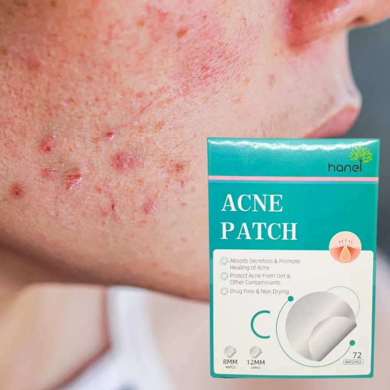Universo en Linea 72 Parches Invisibles Cubre Acne Espinillas Granos