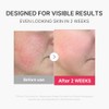Medicube Mini Booster Pro Plus Dispositivo Facial Piel Radiante Calmante