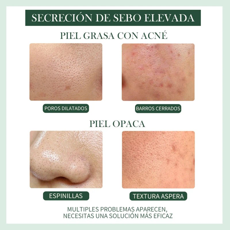 Sérum Oxyglow Con Ácido Láctico y Hialurónico Exfoliante Piel Grasa