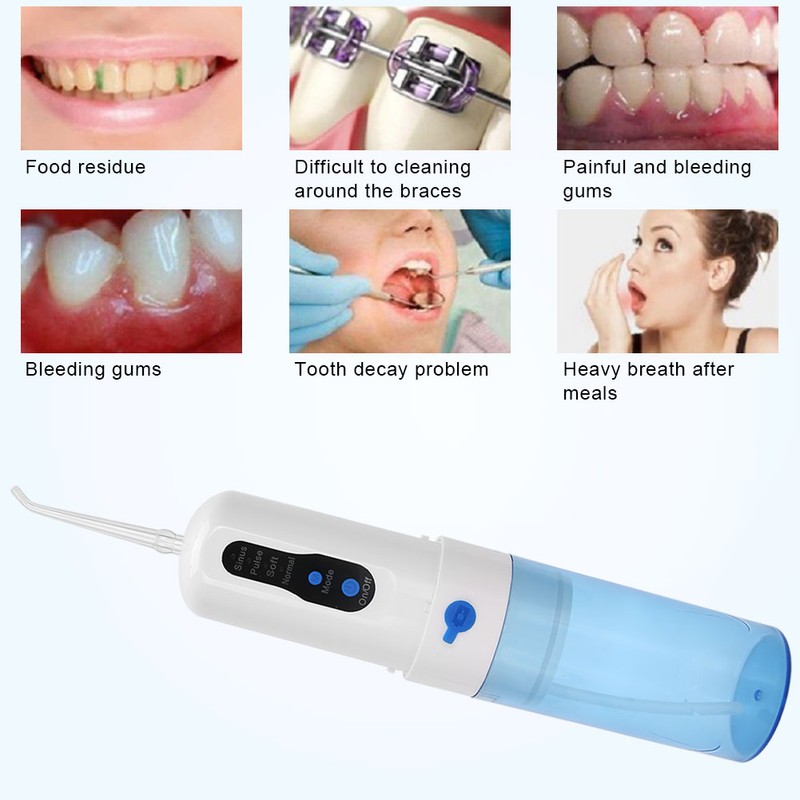 Electric Oral Irrigator Water Flosser Portable USB Charging Home Teeth