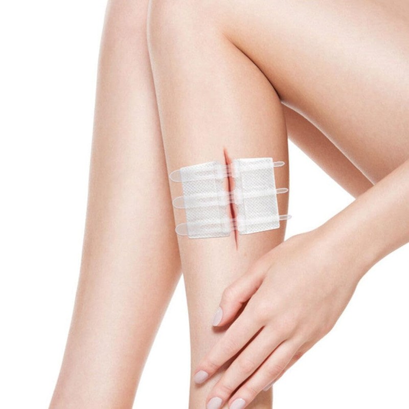 Beavorty 1 Set Zip Stitch with Wound Dresssings WoundClosure Strips
