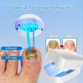 4 PCS UV LED Nail Device, Portable Dual Power Battery/ USB, Low Voltage ≤36V, Rechargeable Lithium Battery, Odorless Treatment for Thick Pigmented Nails, Suitable for Toenails - Color: 2PCS-White*White