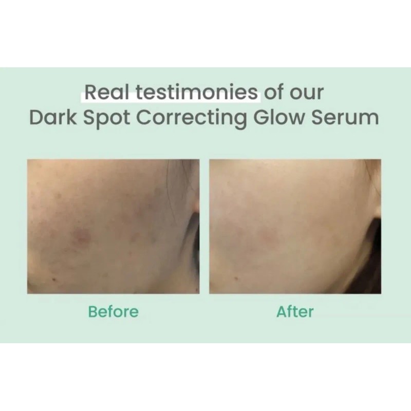 Serum Axis-y Dark Spot Correcting Glow Niacinamida 5 50ml Rostro