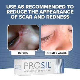 BIODERMIS - Barra de silicona ProSil para cicatrices queloides e hipertóficas que se deslizan en un aplicador potente y fácil de usar, 4,25 gramos. (Cantidad 1) por Prosil El empaque puede variar
