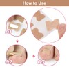 Ingrown Toenails Set, Toenail Correction, Toenail Patch, Toenail Correction Patch,