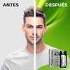 Folcress Shampoo Control Caspa con Piritionato de Zinc Grisi para