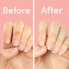 ella+mila Nail Strengthener and Growth Treatment - First Aid Kiss