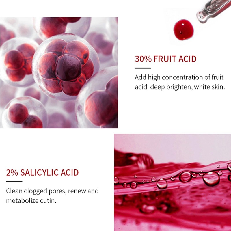 AHA 30% + BHA 2% Peeling Solution, Chemical Peel for