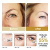 RAZONIX Caffeine Under Eye Cream Anti Aging for Lines and