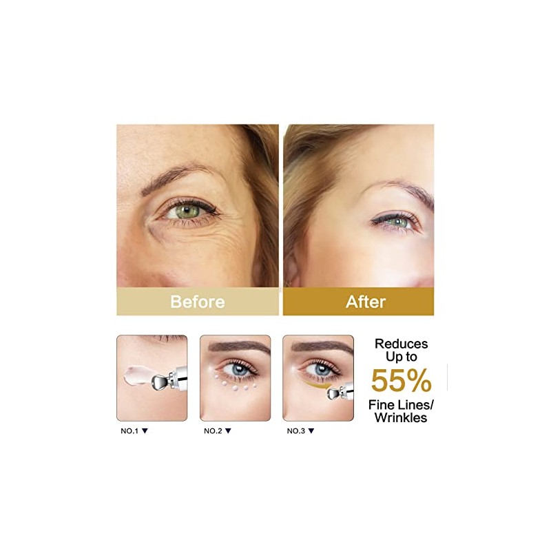 RAZONIX Caffeine Under Eye Cream Anti Aging for Lines and