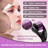 Derma Roller Needles 2.0 mm 540 Titanium Micro Needles for