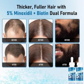 Suero Para El Crecimiento Del Cabello Y La Barba Con 5 % De