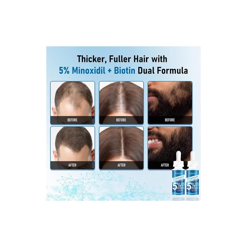 Suero Para El Crecimiento Del Cabello Y La Barba Con