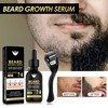 Beard Growth Kit With Roller & Mild Essential Oil -