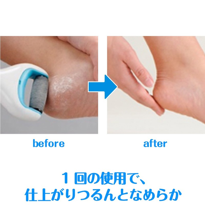 REKITT BENKEISER JAPAN Doctor Shawl Velvet Smooth Electric Exfoliating Remover
