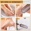 Professional Stainless Steel Callus Remover Kit, Callus Remover Callus Dead
