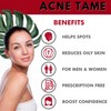 Acnetame Acne Pills Acne Tame- Clear Skin Vitamins, Oily Skin