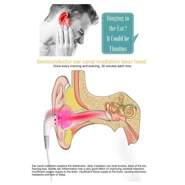 BoltSafe Tinnitus Relief Earplugs | Red Light Laser Therapy | Reusable, Non-Invasive | Reduces Ringing, Improves Blood Circulation | Ear Buds for Ringing Ears