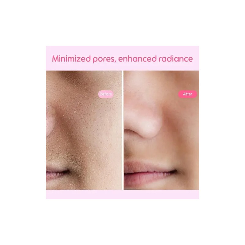 Pads Tónicos Faciales Equilibrantes 190ml, Kiero Todo Tipo De Piel