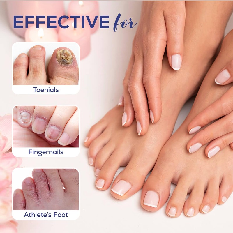 Nail Repair Solution and Nail Care Kit