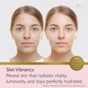 Revitale Advanced Salicylic Acid Cream for Face & Body 80g