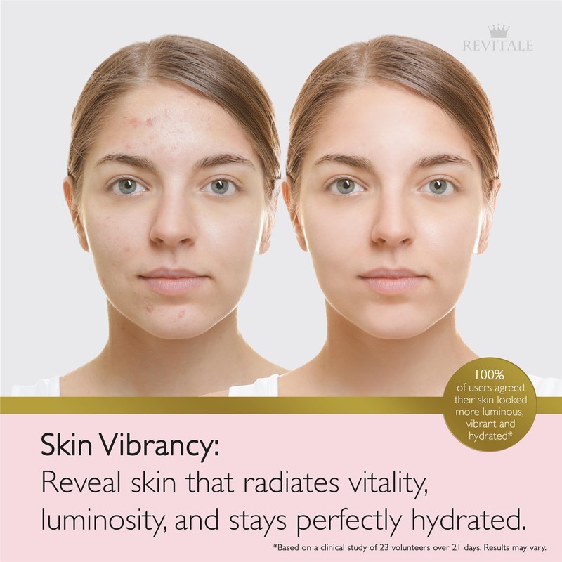 Revitale Advanced Salicylic Acid Cream for Face & Body 80g