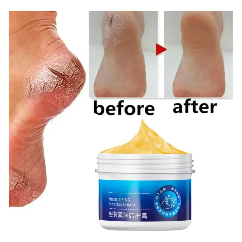 Crema Antisequedad Para Reparar Las Grietas De Los Pies Y
