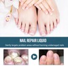Advanced Nail Formula for Toenail and Fingernail - Nourishing and