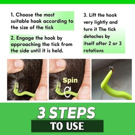 YANAM 4 Pack Tick Remover Tool Set, Tick Removal of Head and Body, Lightweight &Portable Painless Tool With Storage Box(GREEN)