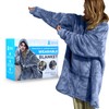 Dialysis Clothing Dialysis Sweatshirts with Arm Zipper | Oversized Wearable